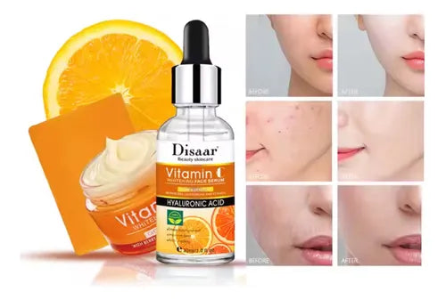 SET DE VITAMINA C PARA EL CUIDADO DE LA PIEL REMOVEDOR DE MANCHAS OSCURAS
